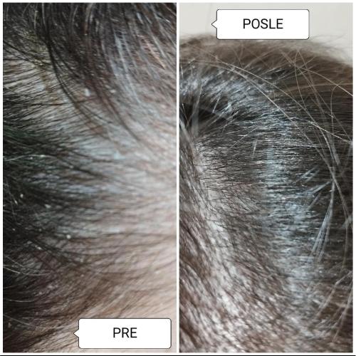 image(43) â kopija