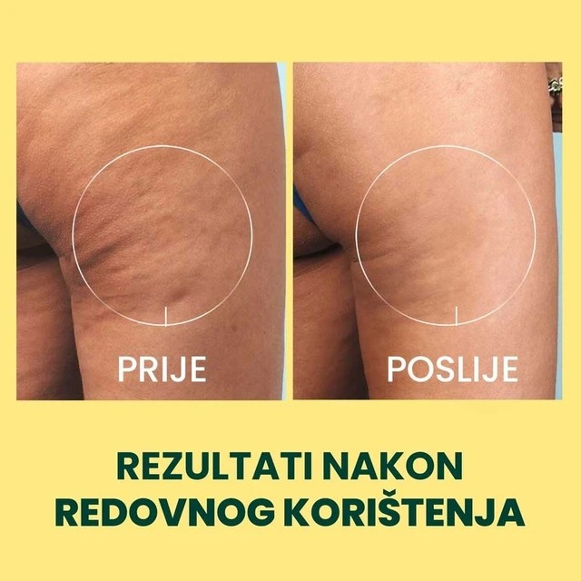 image SRPSKI