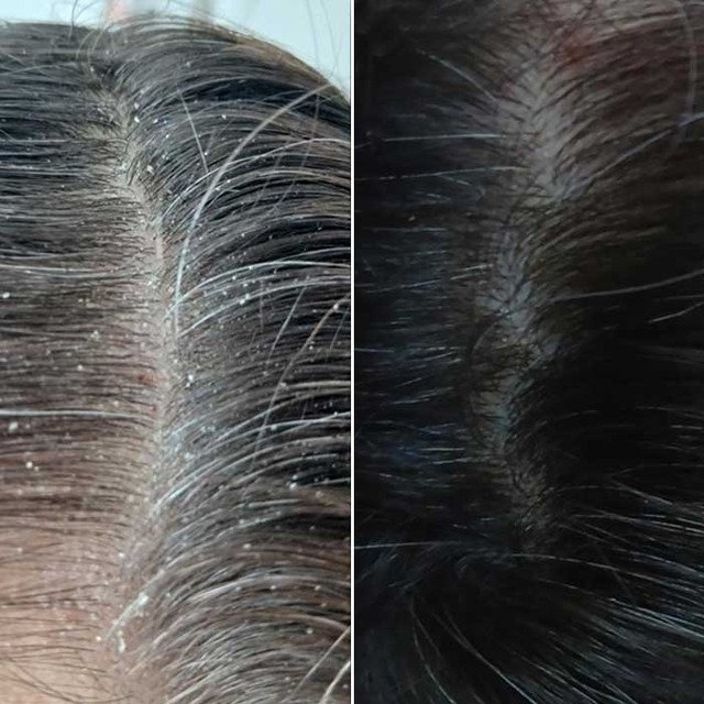 image(3) â kopija